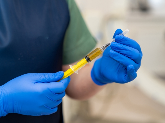 PRF Injections in Birmingham, AL | Pure Esthetics - PRF-Injections-1